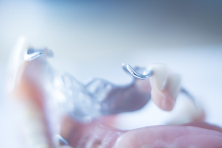 Removable partial denture metal and plastic dental false teeth prosthetics.