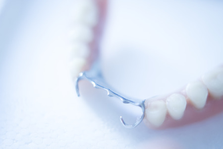 Removable partial denture metal and plastic dental false teeth prosthetics.の写真素材