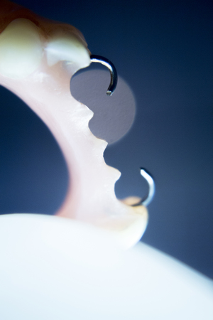 Removable partial denture metal and plastic dental false teeth prosthetic.の写真素材