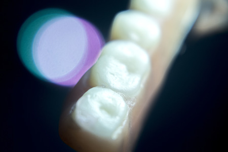 Removable partial denture metal and plastic dental false teeth prosthetic.の写真素材