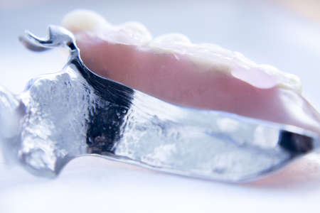 Removable partial denture metal and plastic dental false teeth prosthetic.