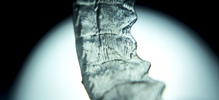 Invisible dental aligners modern tooth brackets transparent teeth braces to straighten teeth in cosmetic dentistry and orthodontics.の写真素材