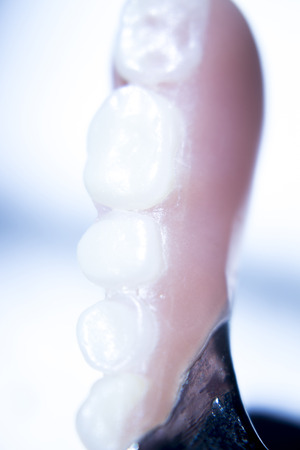 Removable partial denture metal and plastic dental false teeth prosthetic.の写真素材