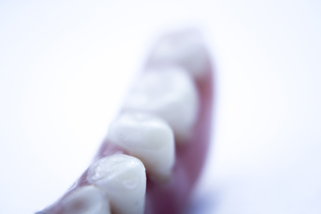 Removable partial denture metal and plastic dental false teeth prosthetic.の写真素材
