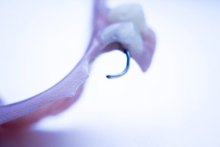 Removable partial denture metal and plastic dental false teeth prosthetic.
