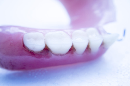 Removable partial denture metal and plastic dental false teeth prosthetic.
