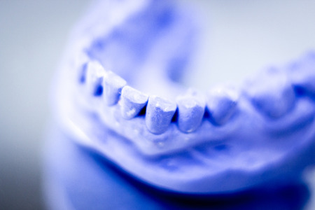 Dental prosthetics clay tooth mold in dentists photo.