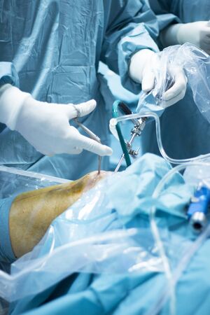 Knee arthroscopy orthopedic surgery operation in hospital operating room photo showing surgeon with...