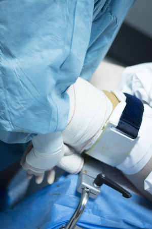 Knee arthroscopy orthopedic surgery operation in hospital emergency operating room photo.の写真素材