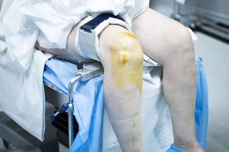 Knee arthroscopy orthopedic surgery operation in hospital emergency operating room sterilization of...