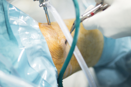Orthopedics knee surgery Traumatology hospital surgical operation photo.の写真素材