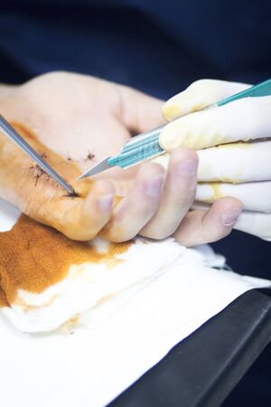 Hospital hand surgery orthopedics operation photo.