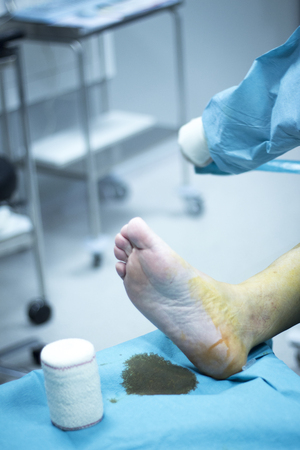 Knee arthroscopy orthopedic surgery operation in hospital emergency operating room photo.の写真素材