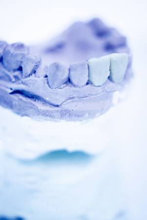 Dental prosthetics clay tooth mold in dentists photo.の写真素材