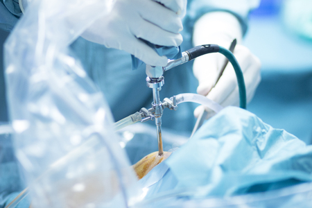Hospital orthopedics Traumatology surgical operation on torn meniscus in knee emergency operating...