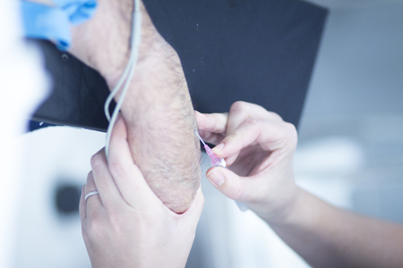 Hand and arm surgery orthopedics operation emergency operating room photo.の写真素材