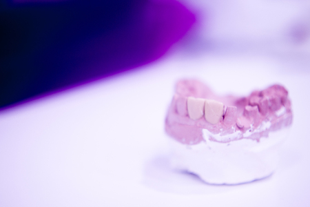 Dental prosthetics clay tooth mold in dentists photo.の写真素材