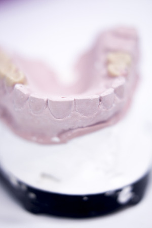 Dental prosthetics clay tooth mold in dentists photo.