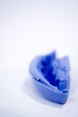 Dental prosthetics clay tooth mold in dentists photo.