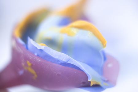 Dental mold dental impression plate in dentist's clinic.の写真素材