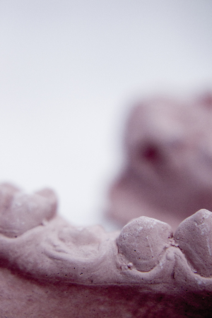 Dental prosthetics clay tooth mold in dentists laboratory photo.