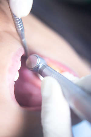 Dentist examining patient mouth in dental exam with dentist's drill instrumentation in clinic.