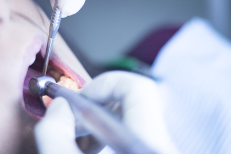 Dentist examining patient mouth in dental exam with dentist's drill instrumentation in clinic.の写真素材