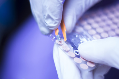 Auriculartherapy oriental acupunture ear seed sticker plaster auriculatherapy treatment physiotherapy. Physiotherapist in hospital clinic,の写真素材