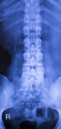 Neck and spine xray traumatology and orthopedics spinal vertebra test medical scan used to diagnose...