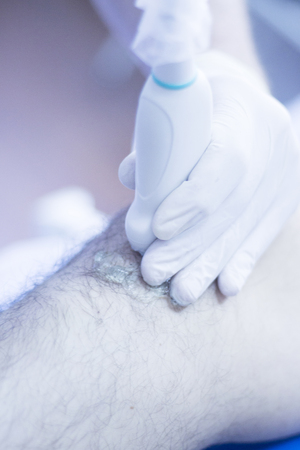 Dry needling acupunture therapy with acupunturist physiotherapist in hospital clinic.の写真素材