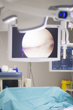 Arthroscopy surgery screen showing arthroscope camera picture in knee meniscus surgical operation to repair injuryの写真素材