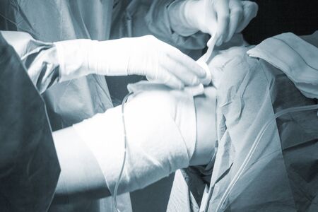 Nurse bandaging after Surgical operation knee arthroscopy micro surgery in hospital operating theatre emergency room for orthopedics.の写真素材