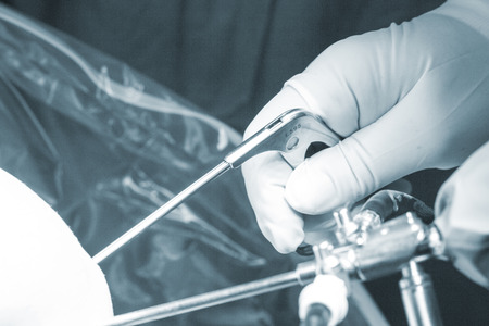 Surgical operation for knee arthroscopy micro surgery in hospital operating theater emergency room of traumatology and orthopedics.の写真素材