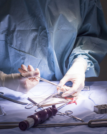 Knee tendon and ligament repair surgery in hospital operating theater emergency room for...