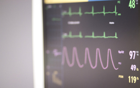 Electrocardiograph in hospital surgery operating theater emergency room showing patient heart rate.の写真素材