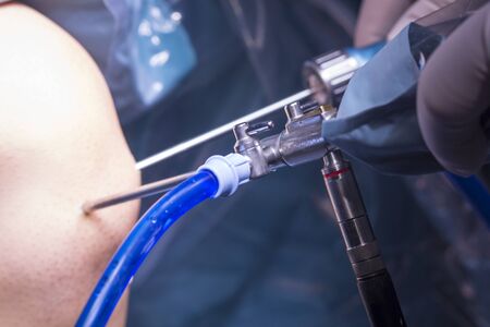 Surgical operation for knee arthroscopy micro surgery in hospital operating theater emergency room of traumatology and orthopedics.の写真素材
