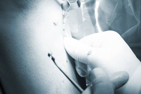 Surgical operation knee arthroscopy micro surgery on knee, tendon, ligament and meniscus  in...