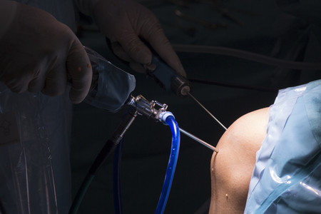 Surgical operation knee arthroscopy micro surgery in hospital operating theater emergency room for...