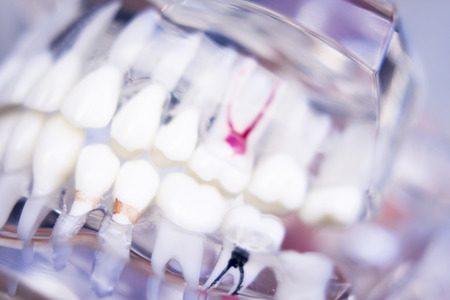 Dentists tooth plastic model used for teaching, learning and patient consultations in dental office showing teeth and gums.の写真素材