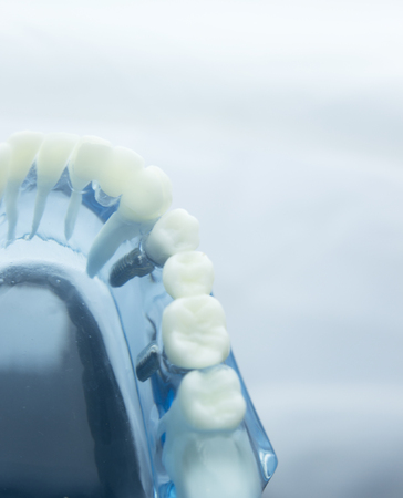 Dental tooth dentistry student learning teaching model showing teeth, roots, gums, gum disease,...