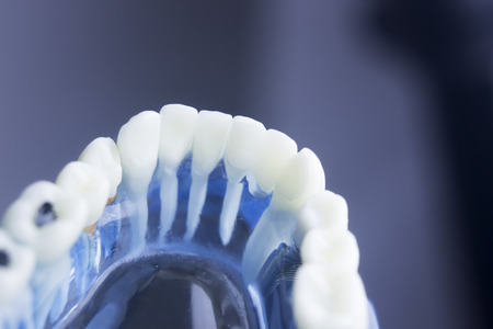 Dental tooth dentistry student learning teaching model showing teeth, roots, gums, gum disease,...