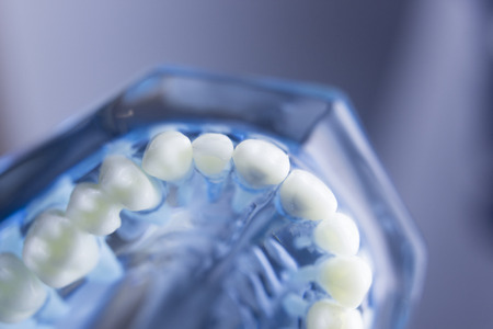 Dental tooth dentistry student learning teaching model showing teeth, roots, gums, gum disease, tooth decay and plaque.の写真素材