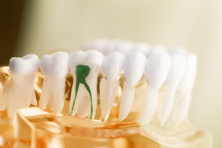 Dental tooth dentistry student learning teaching model showing teeth, roots, gums, gum disease, tooth decay and plaque.の写真素材