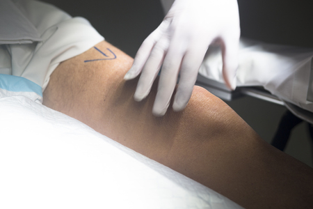 Patient leg in operating theater with surgical bandage in hospital emergency room surgeryの写真素材