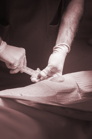 Anaesthtist anaesthetic injection in knee for surgery hospital operation medical procedure in emergency room operating theater.の写真素材