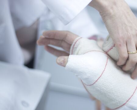 Doctor applying a plaster cast and bandages to patient forearm and wrist to immobilize after fracture injury.の写真素材
