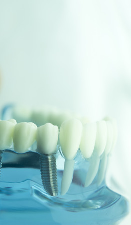 Dental tooth dentistry student learning teaching model showing teeth, roots, gums, gum disease,...