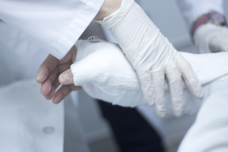Doctor applying a plaster cast and bandages to patient forearm and wrist to immobilize after fracture injury.の写真素材