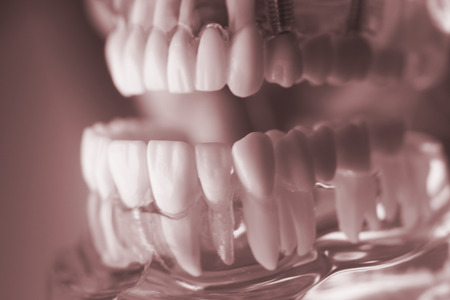 Dental tooth dentistry student learning teaching model showing teeth, roots, gums, gum disease, tooth decay and plaque.の写真素材