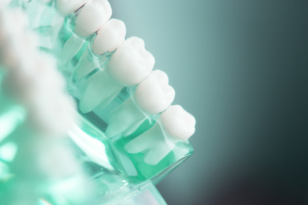 Dental tooth dentistry student learning teaching model showing teeth, roots, gums, gum disease,...